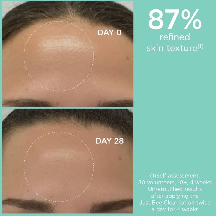 Uso recomendado mañana y noche para mantener el cutis purificado.