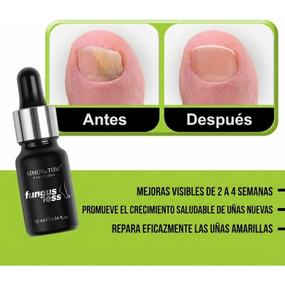 Tratamiento Reparador Integral de Uñas: Fortalecedor... 2