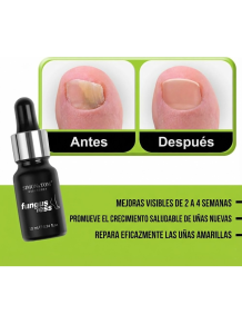 Tratamiento Reparador Integral de Uñas: Fortalecedor Quimio y/o Antihongos - Fungusless (Simon & Tom)