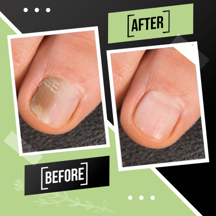 Tratamiento Reparador Integral de Uñas:...