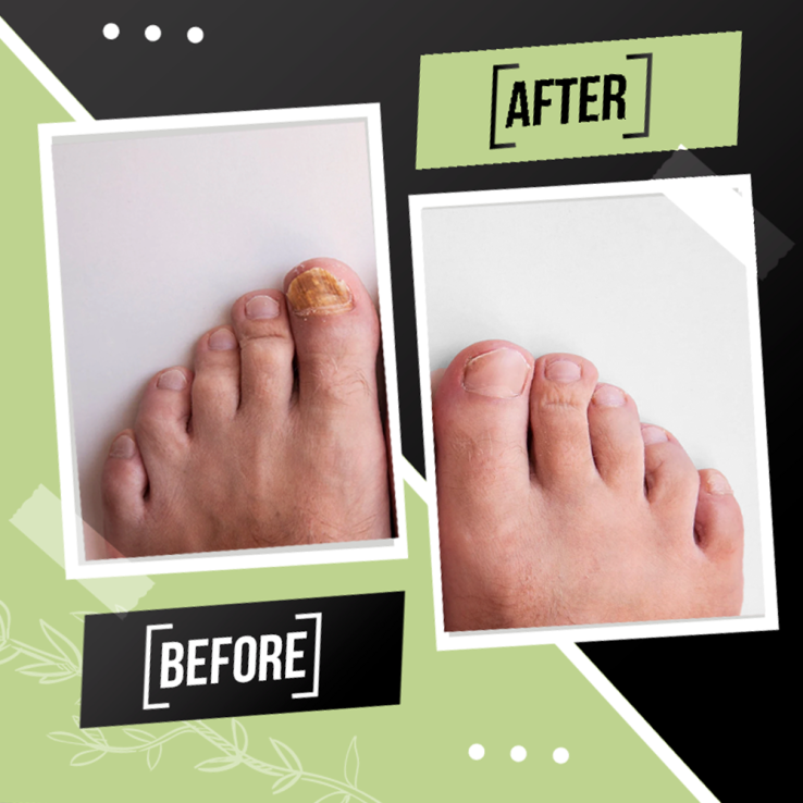 Tratamiento Reparador Integral de Uñas:...