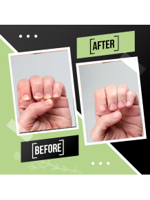 Tratamiento Reparador Integral de Uñas: Fortalecedor Quimio y/o Antihongos - Fungusless (Simon & Tom)